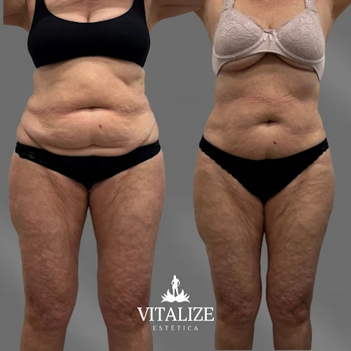 Registro de antes e depois de cliente da Vitalize